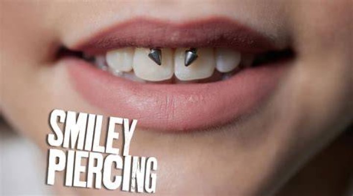 Do Smiley piercings reject? | ContextResponse.com