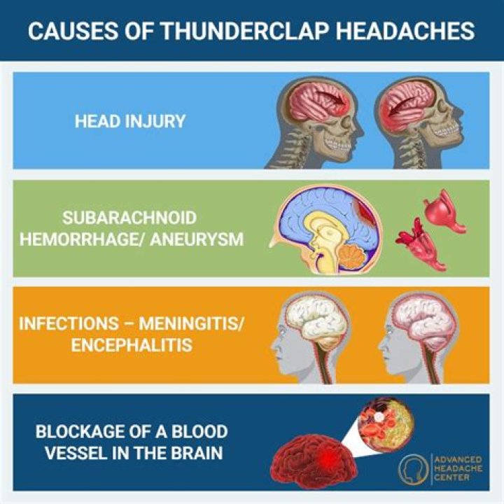 What is a thunderclap headache?