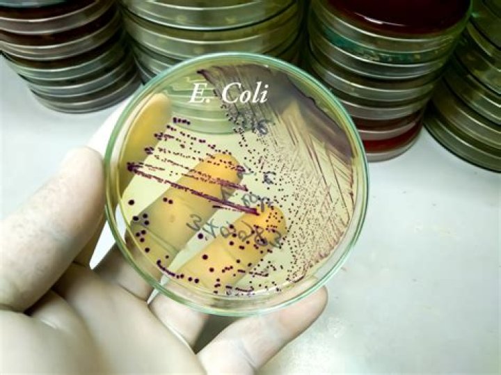 What is E coli o157 found in?